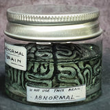 Cervello abnormal - Frankenstein Junior